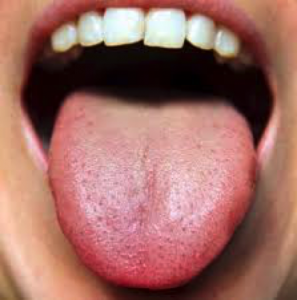 Tongue picture